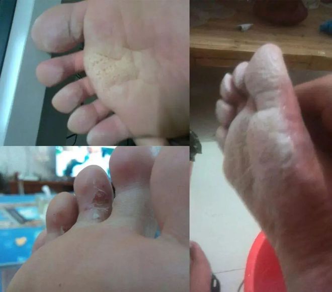 九游娱乐网站：这双「鞋」陪你爬山涉水！走10000步不累脚抬脚都有风从趾间过…(图4)