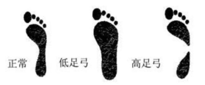九游娱乐平台：50双休闲跑鞋全面测试哪双让你步伐更轻盈？｜申评测(图17)